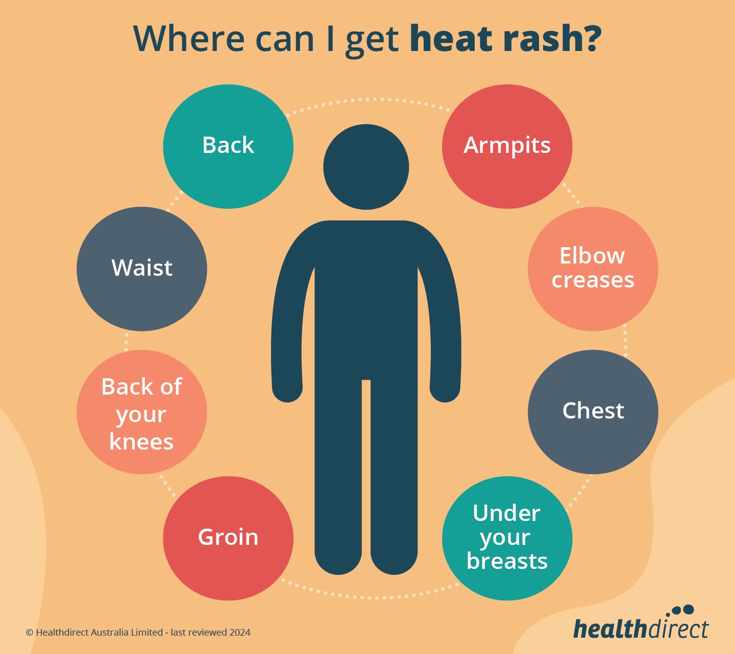 Places where heats rash can occur: Back, Armpits, Waist, Elbow creases, Back of your knees, Chest, Groin and Under your breasts