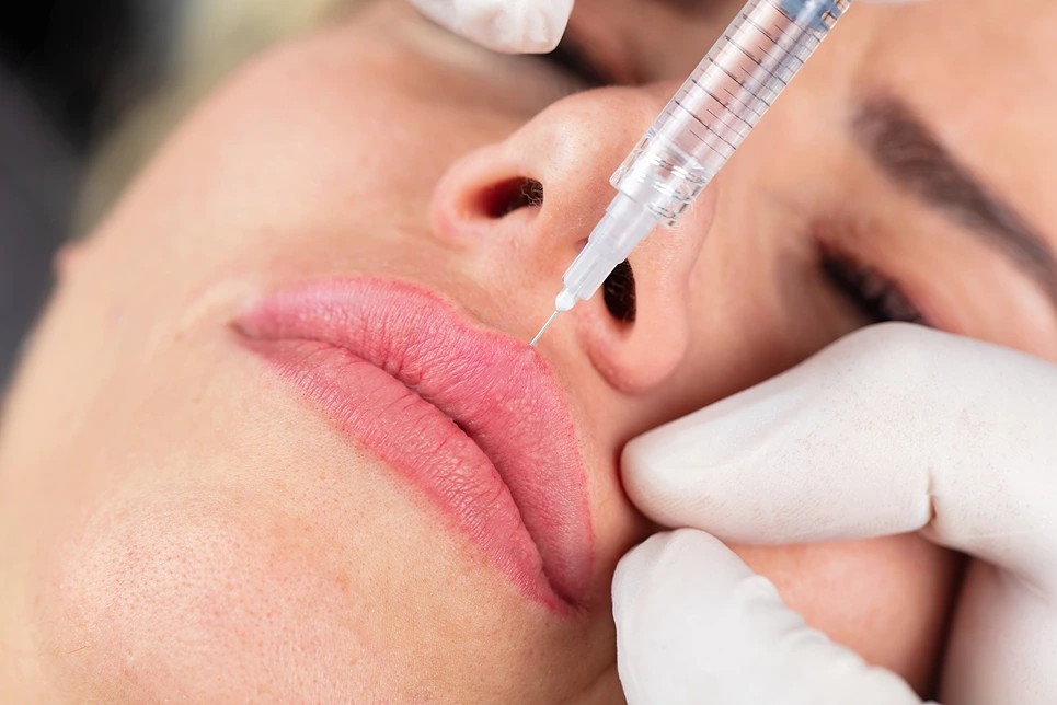Lip Filler Options