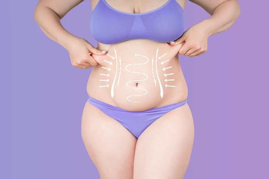 AirSculpting Consultation