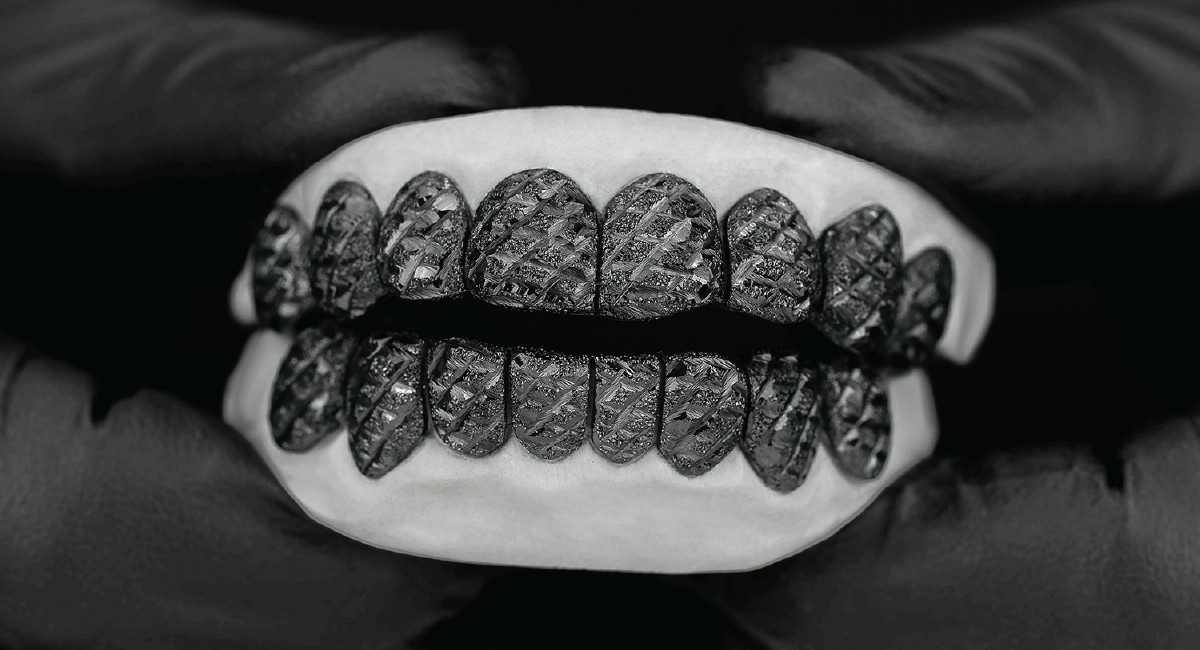 Factors influencing the price of diamond grillz