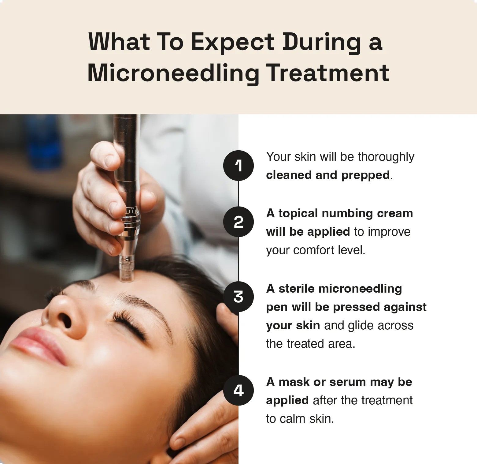 This image illustrates the steps to take during a microneedling appointment, ensuring a smooth and effective procedure.