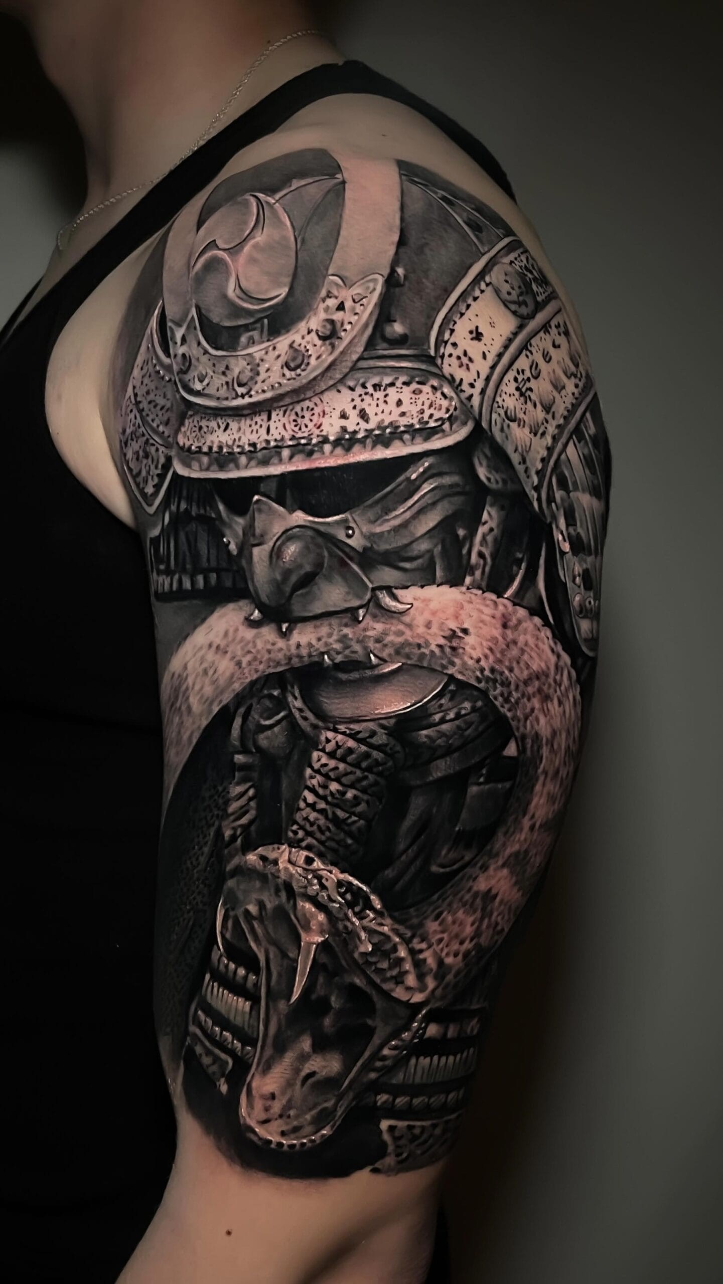 XL Upper Arm