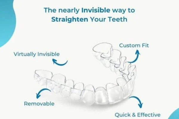 An infographic showcasing ALIGNERCO clear aligners