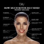 Botox treatment area guide