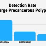 Cologuard vs Colonoscopy Detection Rate of Precancerous Polyps