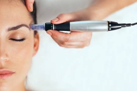 Person receiving Morpheus8 treatment for skin tightening