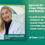 Clear Aligners