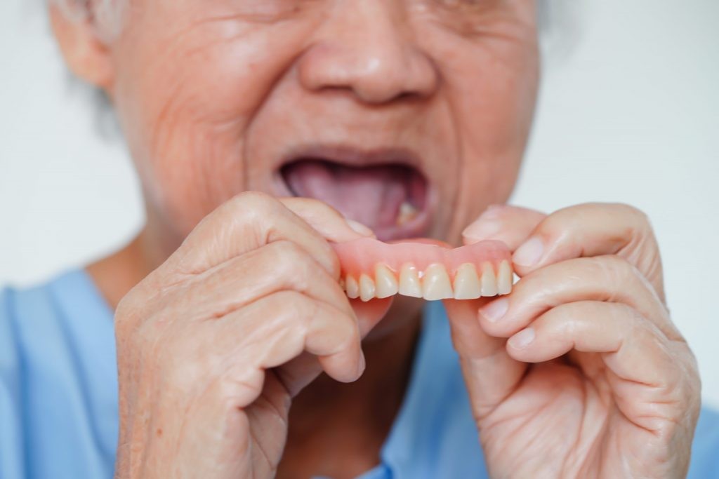 A model demonstrating how implant-supported dentures attach to the jaw.