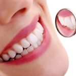 Smiling confidently after orthodontic treatment