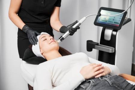 Morpheus8 treatment for facial rejuvenation